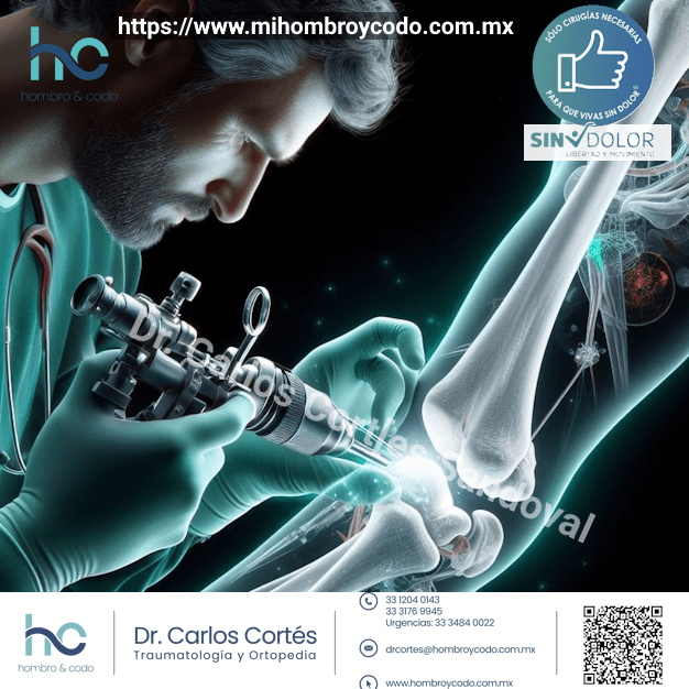 El papel de la artroscopia en el tratamiento del traumatismo de codo en adultos.